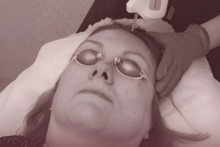 Facial Toning