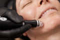 Promotion - Hydrafacial Deluxe Treatment