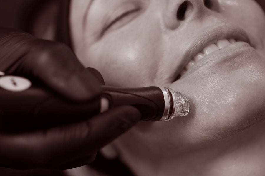Hydrafacial
