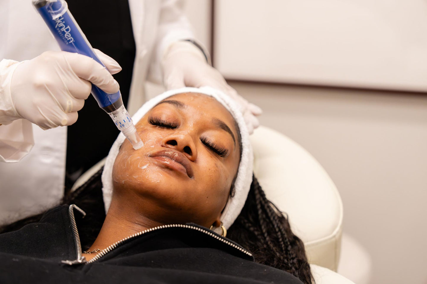 Microneedling
