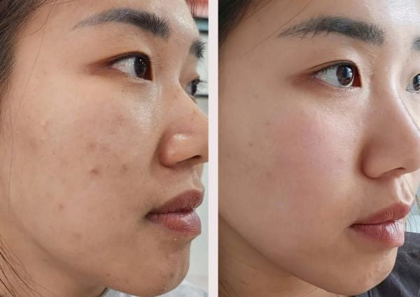 Promotion - Korean Glass Facial