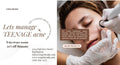 Teenage Acne Hydrafacial Package