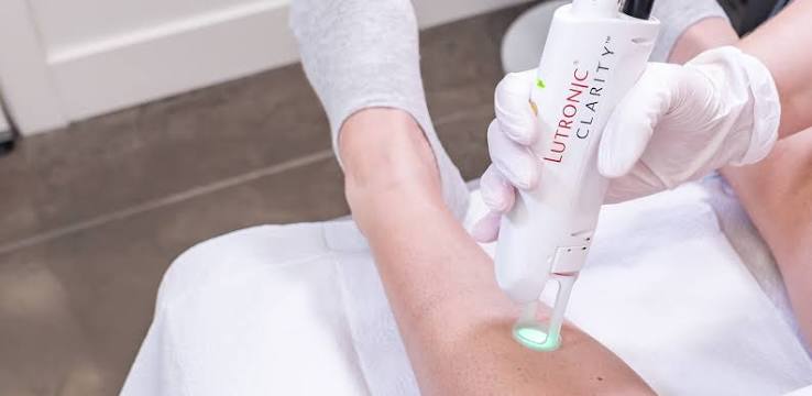 Laser Hair Removal