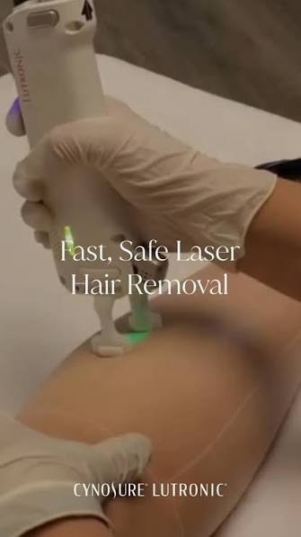 Laser Hair Removal