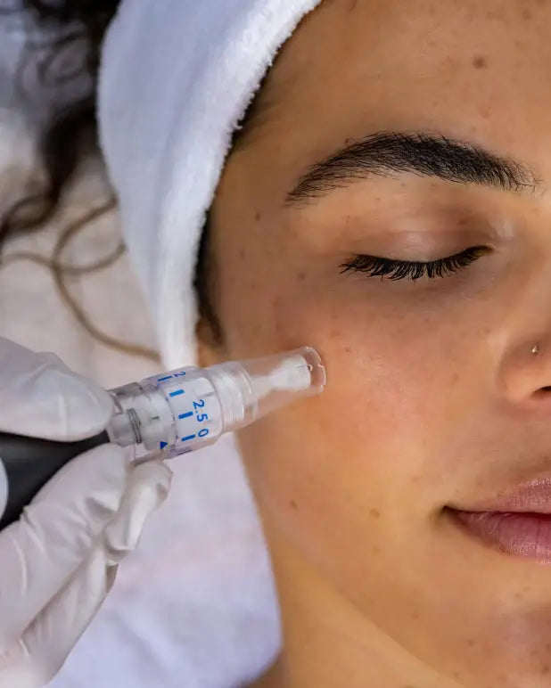 Microneedling