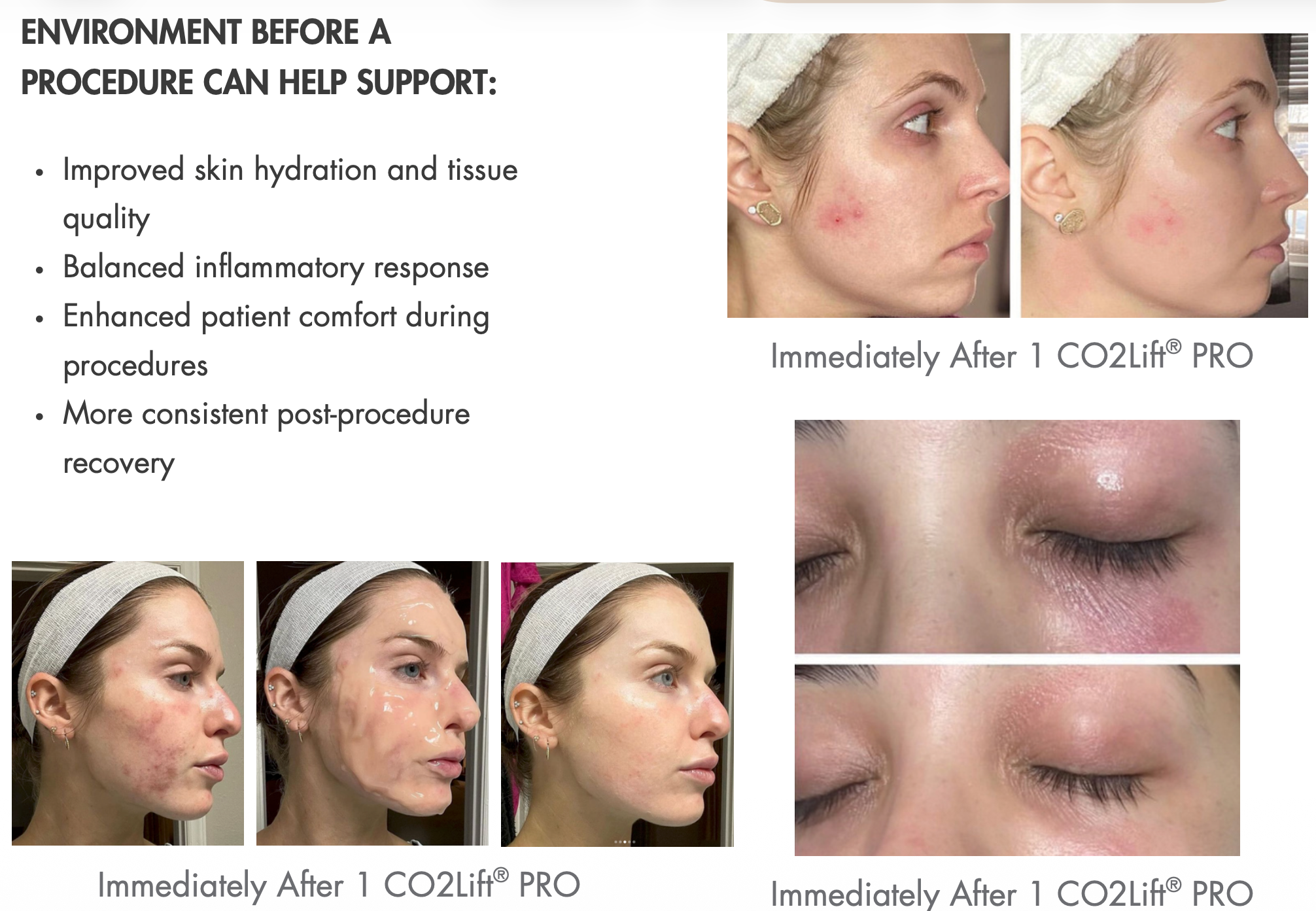 Advance Carboxy Therapy