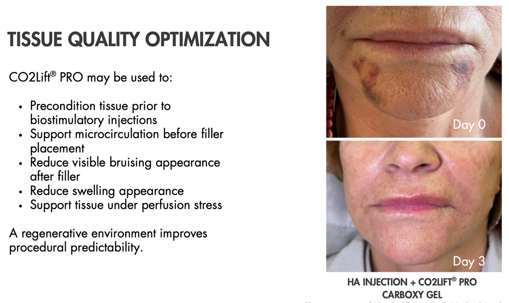 Advance Carboxy Therapy