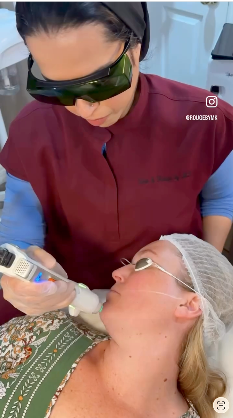 Microneedling + Clarity II Laser Toning | Package