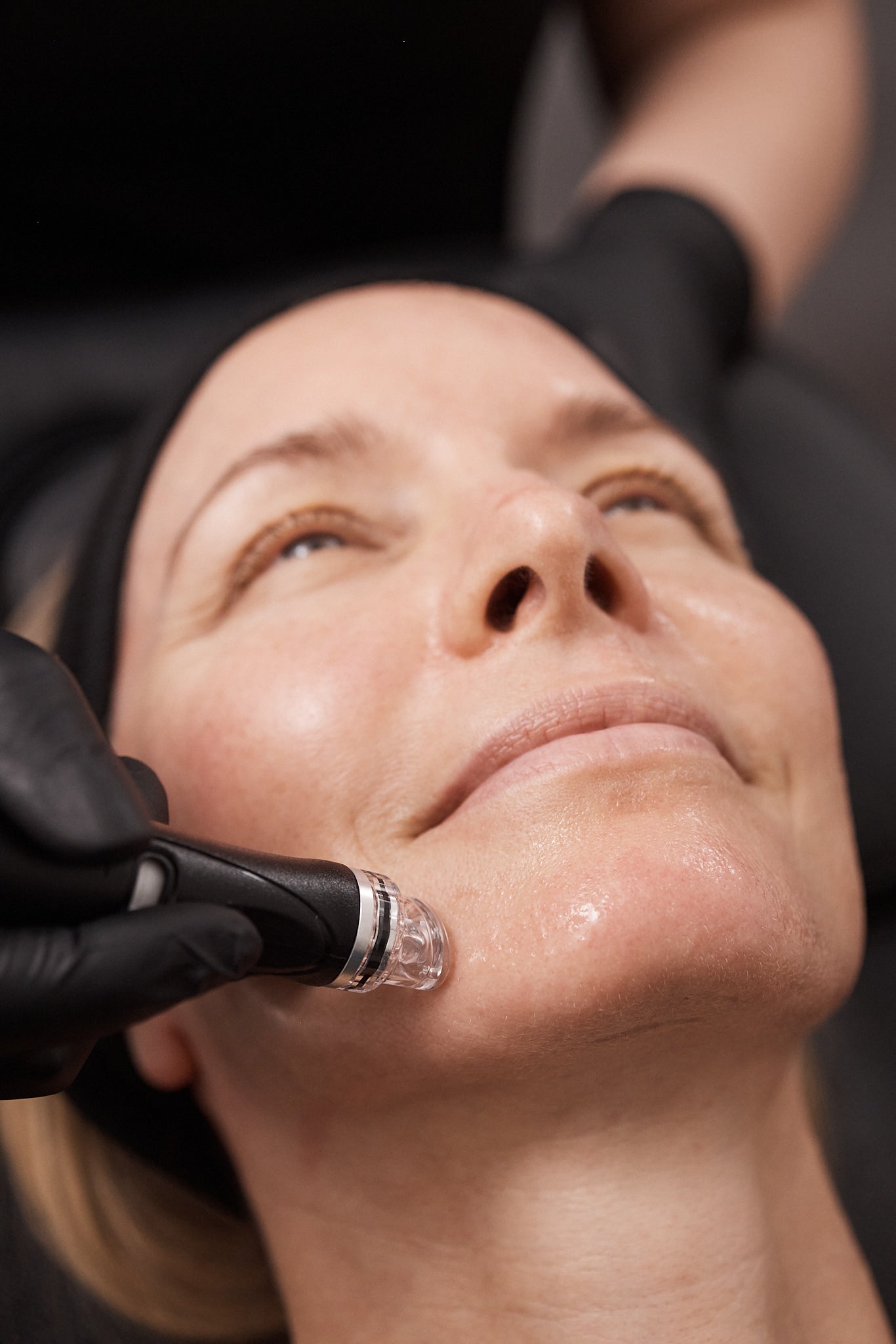 Promotion - Hydrafacial Deluxe Treatment